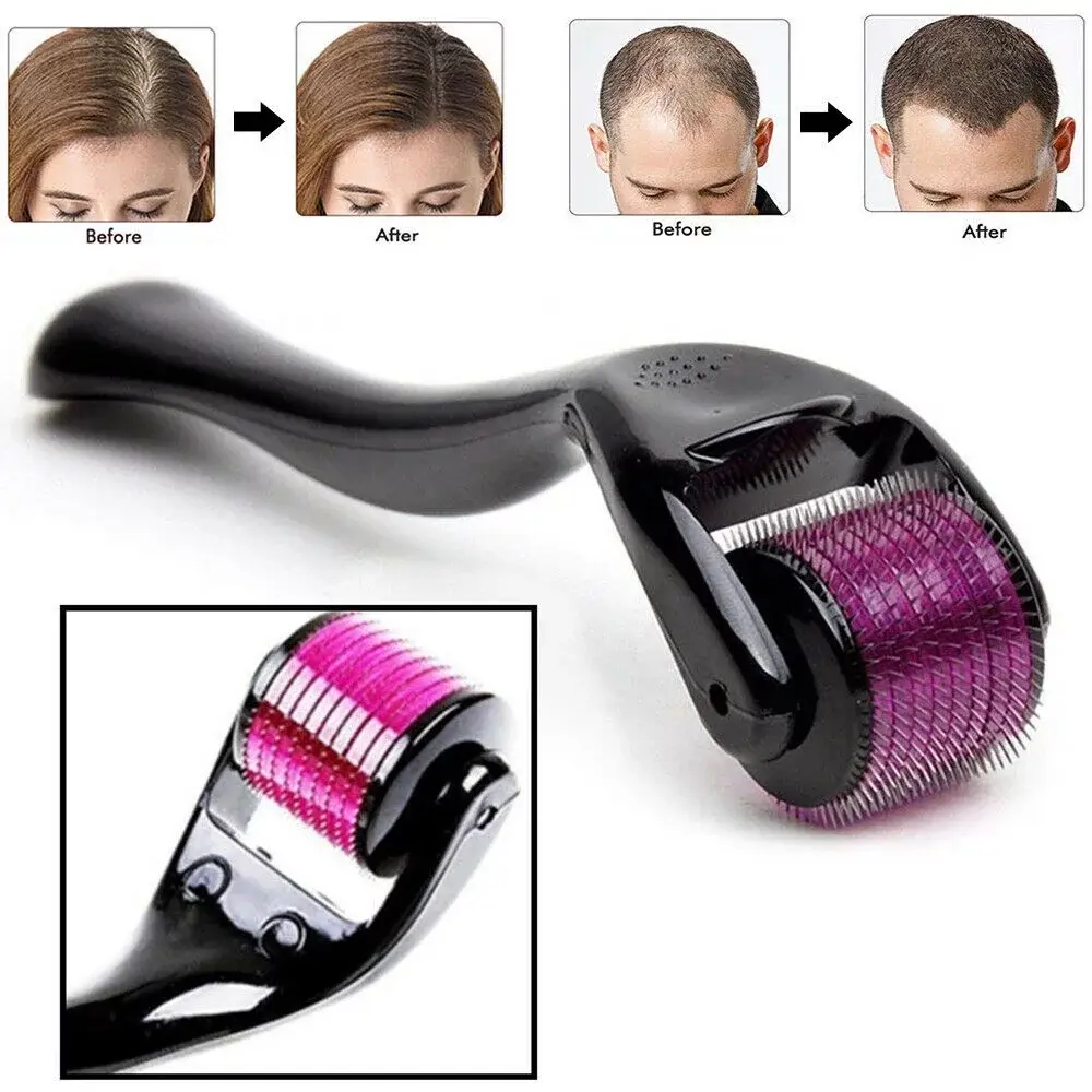 Derma Roller 0.50mm – 540 Alloy Needles Microneedles for Face, Skin & Hair - Image 2