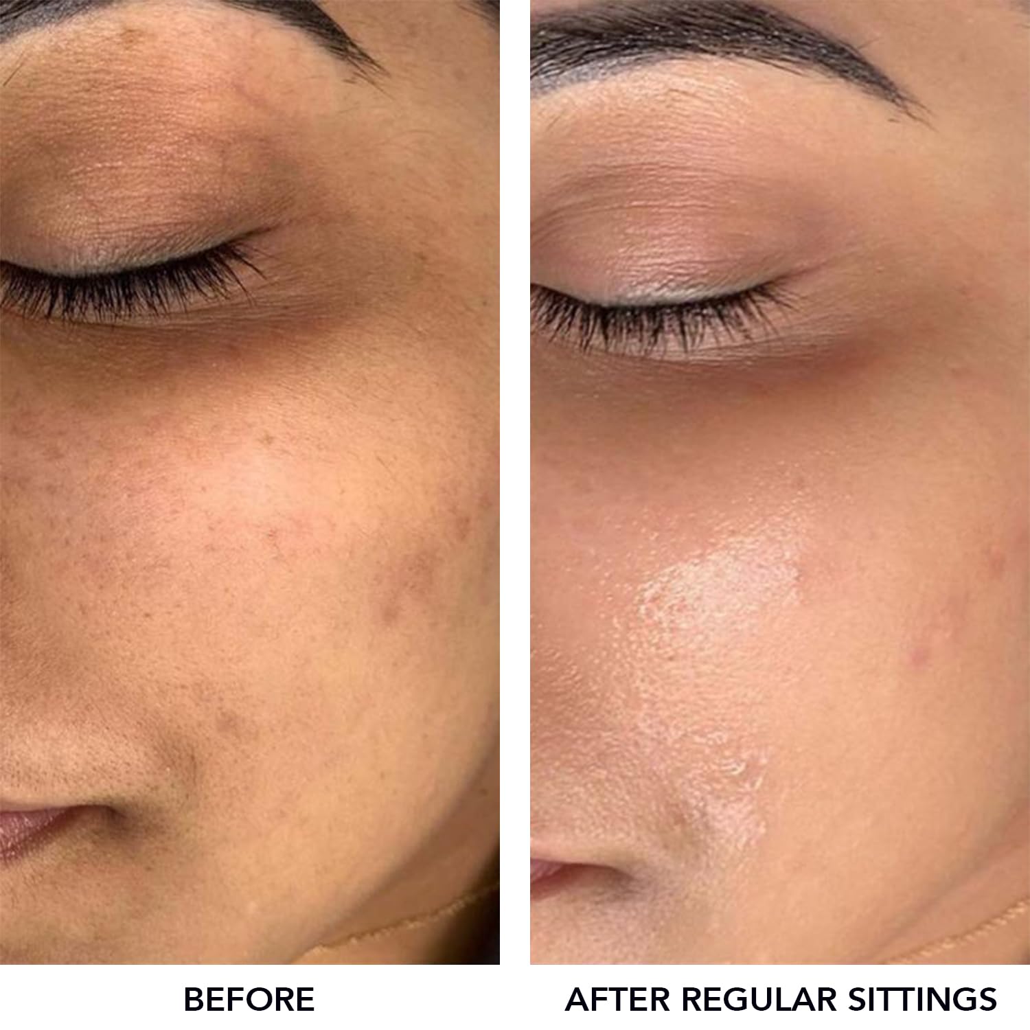 O3+ Meladerm Vitamin C Gel Bleach 96g for Skin Brightening Dull Skin - Image 4